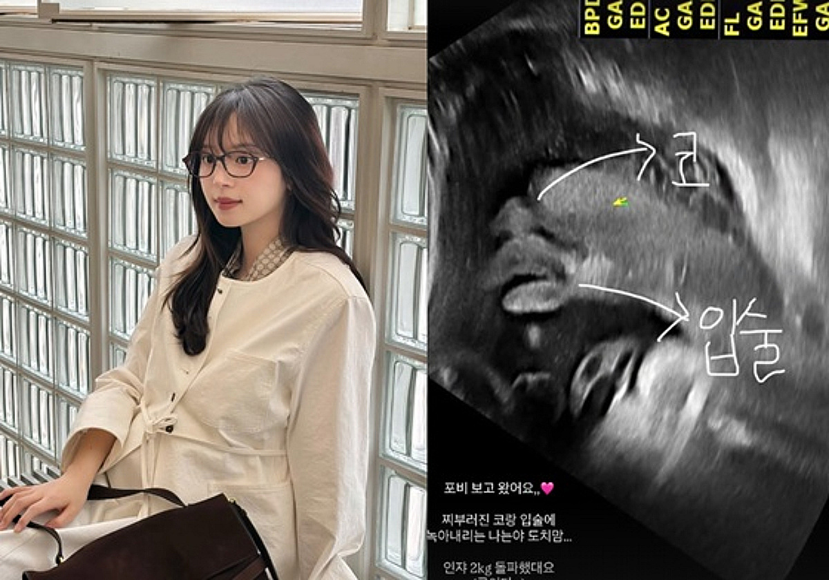 妊娠32週」キム・ジヨン、胎児超音波で鼻と唇を発見「とろけるドチママ