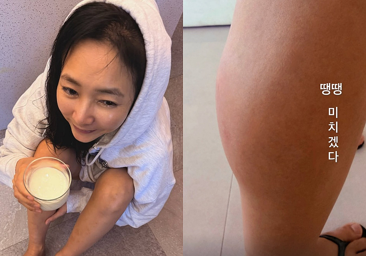진재영, 지네 물림 사고에 다리 퉁퉁.."살다살다 별 일 다 있어"