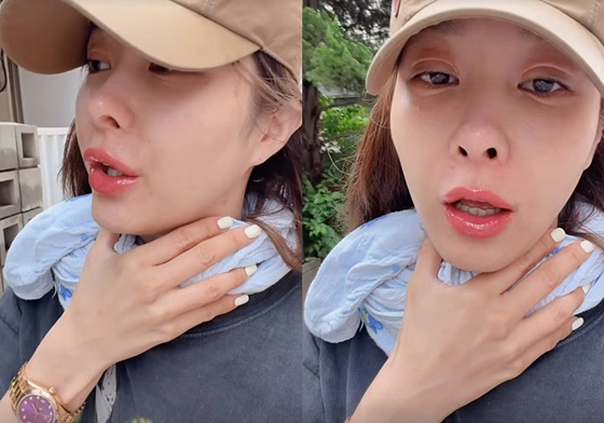 옥주현, 김호영 저격 그 후..건강 관리 당부 "편도염 후두염 조심" [스타이슈]