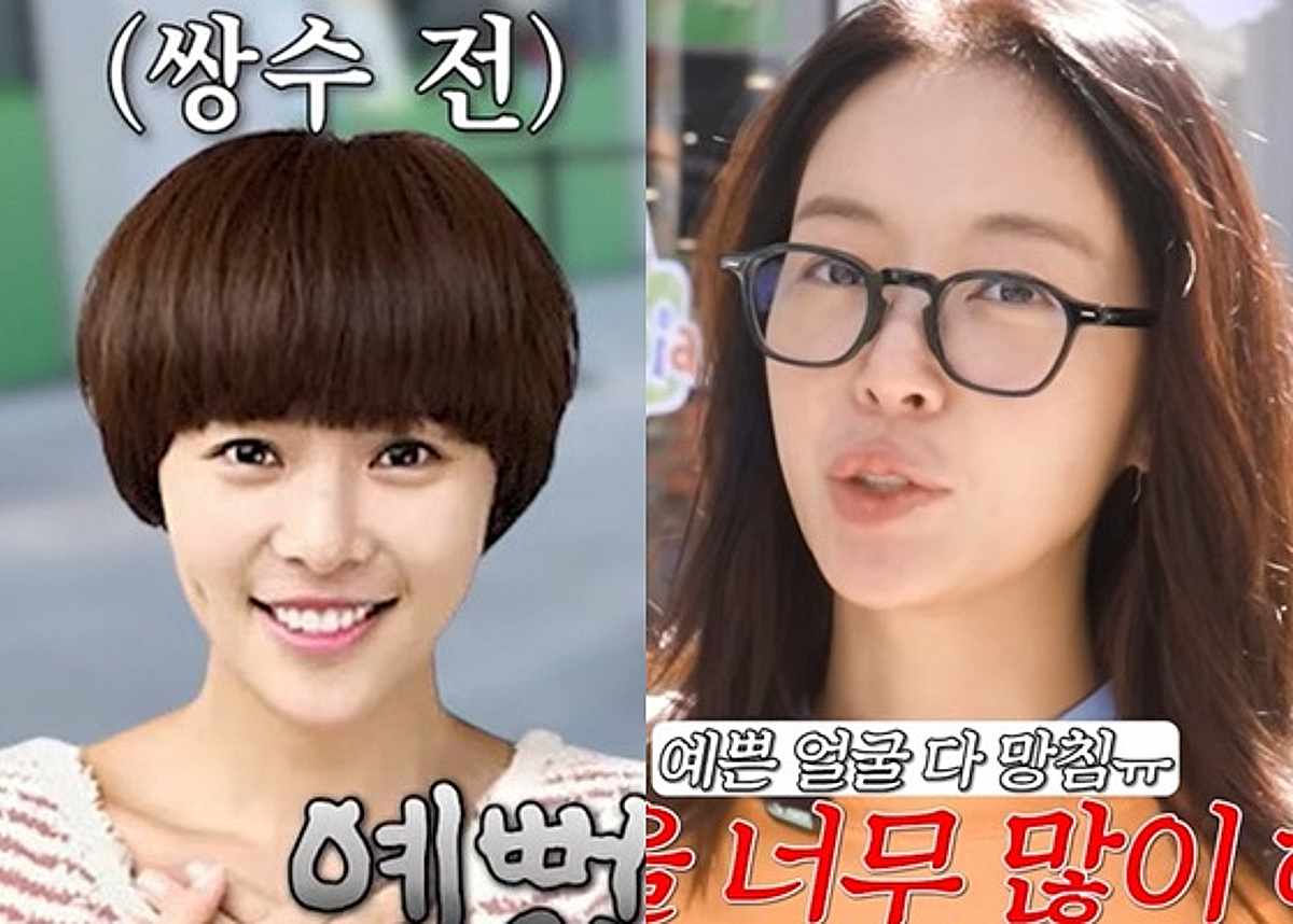 황정음, 과거 사진과 비교해보니.."성형 2천만원, 복구는 2억"
