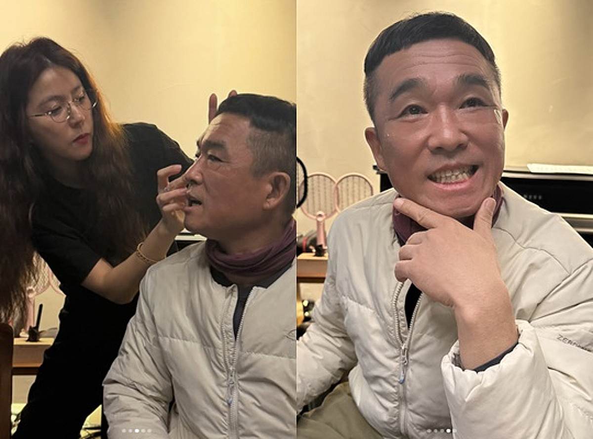 주영훈 아내가 공개한 김건모 근황 공개..눈밑 지방 '삭제'