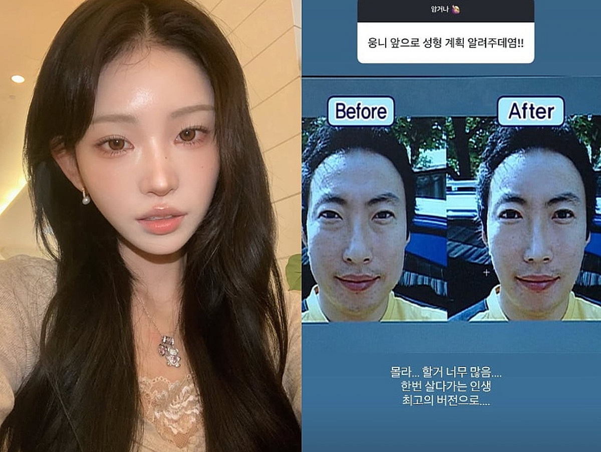 '성괴 인정' 최준희 "할거 너무 많다" 추가 성형 고민中[스타이슈]