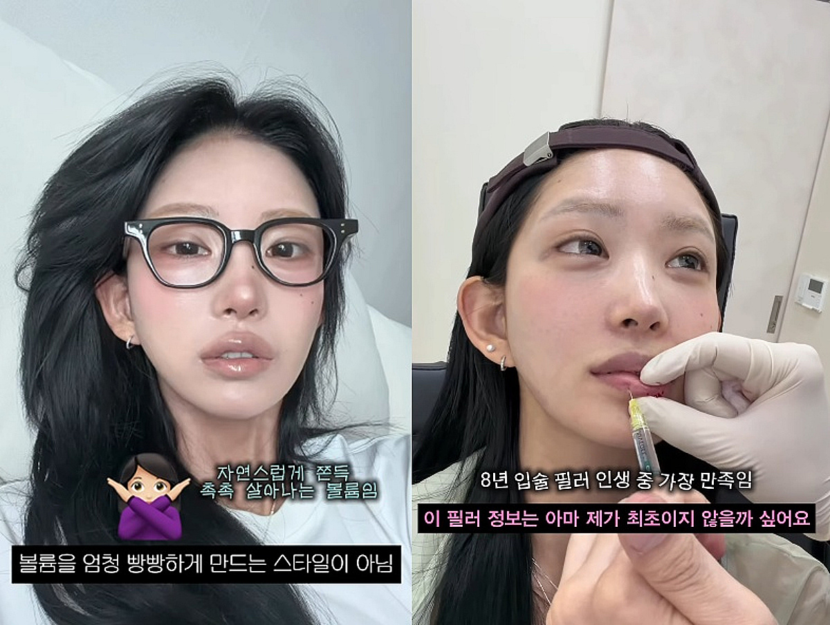 '성괴 인정' 최준희 "18세부터 입술 필러..만족해요" 쿨한 고백[스타이슈]