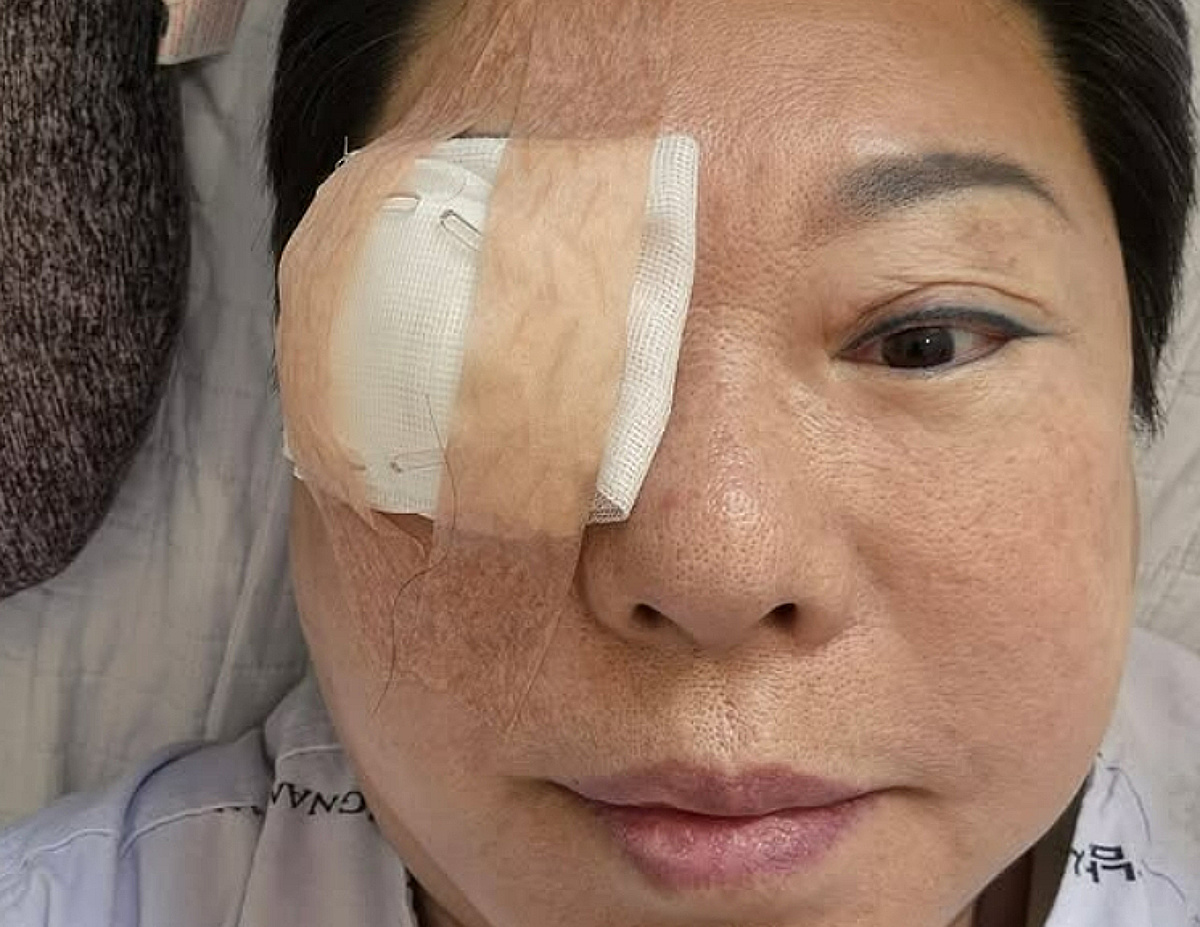 양희은, 각막 이식 수술 후 전한 근황 "여러 날 누워 있어야.."