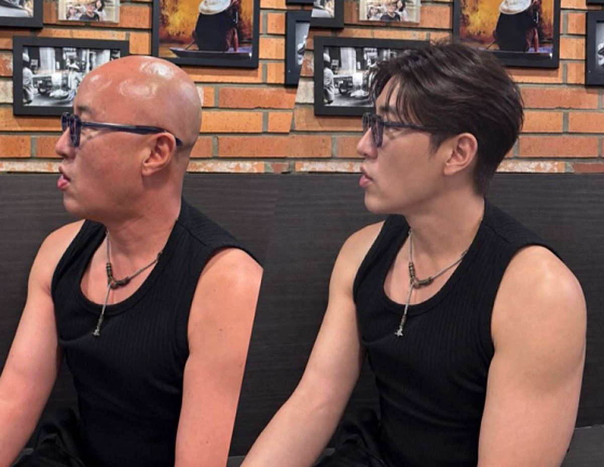 홍석천, 갑자기 머리카락 생겼다..못 알아볼 '가발 합성'[스타이슈]