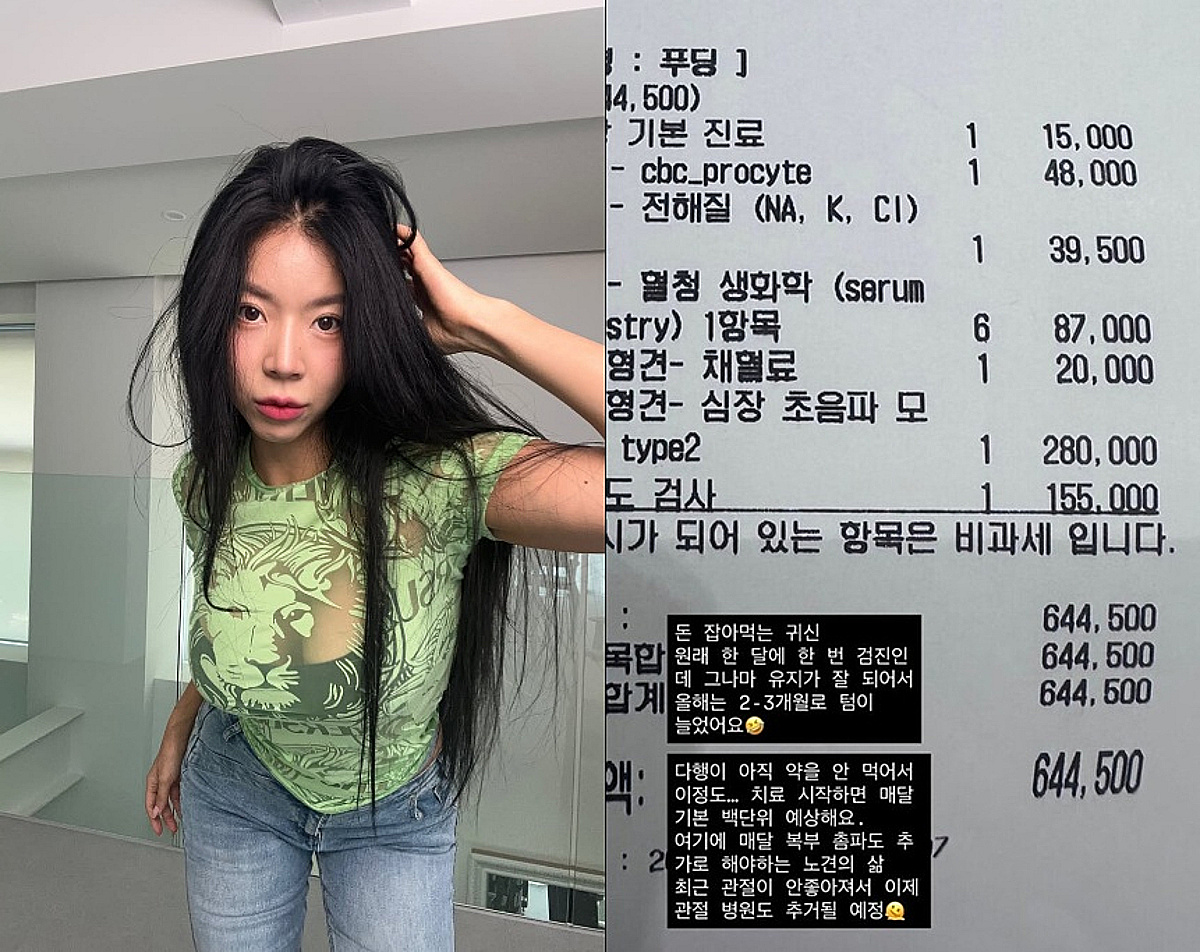 제이제이, 반려견 병원비 64만원 "돈 잡아먹는 귀신" 무슨 일?