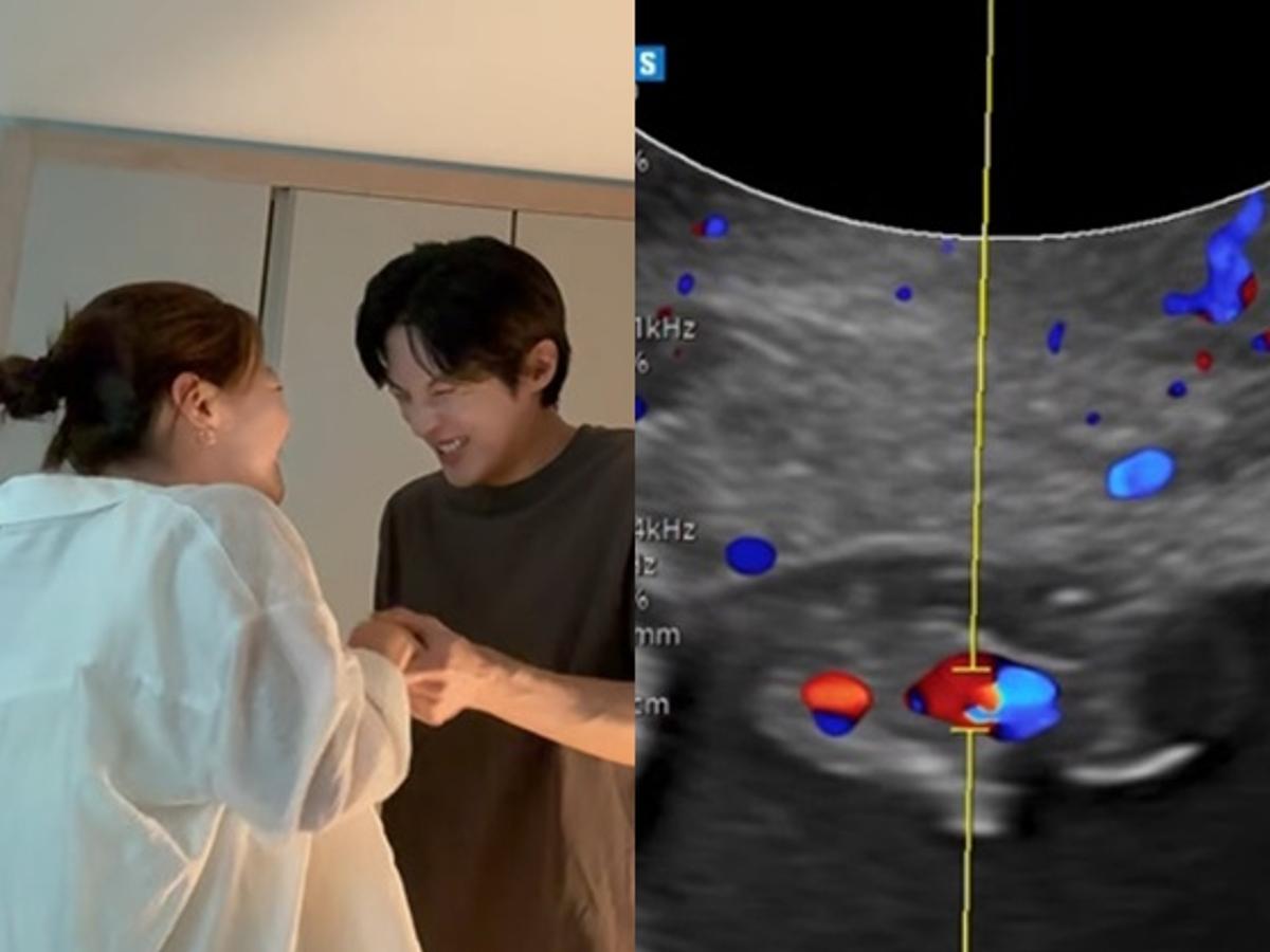 김가은♥윤선우 "아기천사가 찾아왔어요..6식구" 결혼 1주년에 겹경사 [스타이슈]