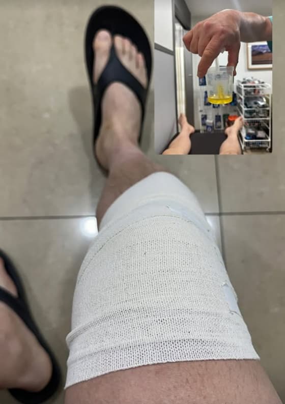 사진=이루 계정