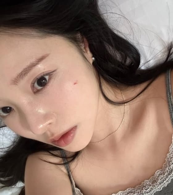 박성광, 사랑꾼이었네..♥이솔이 "자고 있는데 연고 발라줘"