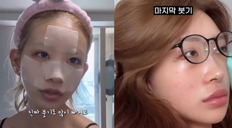 사진=최준희 SNS