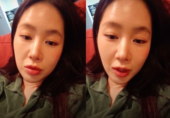 소유, 달라진 얼굴에 성형 의혹.."전과 비교하니까 많이 빠져" 해명