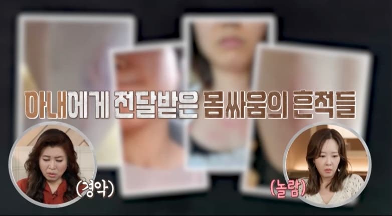 남편, 술만 마시면 '소변 실수+폭력 행동' 경악.."입원 치료해야" [결혼지옥]