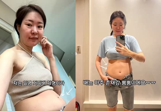 '김태현♥' 미자, 말랐는데 다이어트 하는 이유 "살찌면 배부터..미운 살 울룩불룩"