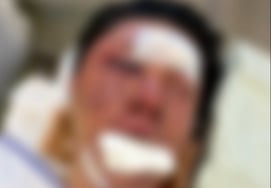 "35 швов за похищение и нападение" ютубер-петух, злоумышленник, написавший 40 раскаяний."Это кислый и злой"