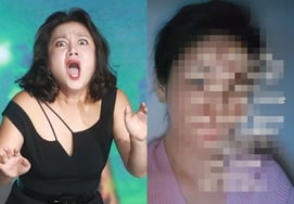 パク・ナレの注射師「人生を終わらせようとしたのに…」「 心境告白 [スター・イシュー]