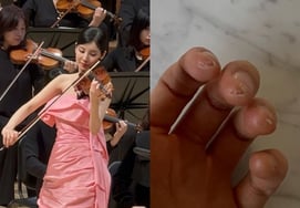 Seohyun, did you care about the "classical preferential treatment controversy"..Fingers blisters burst after practicing the violin hard [Star Issue]