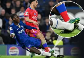 李承烨表示，"脚踝180度大转弯"" 切尔西后卫李康仁被好友踩伤，公开伤势严重照片，"摔断是理所当然的"