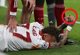 震惊的"指尖晃晃悠悠的"" 在利物浦比赛中经历"截肢危机"的郎，"上厕所也是地狱" 欧洲足联预告将"提起诉讼"