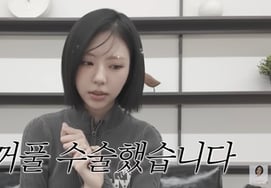 Ким Го сказал: «Я перенес операцию на двойное веко." Внезапное признание [человек.]