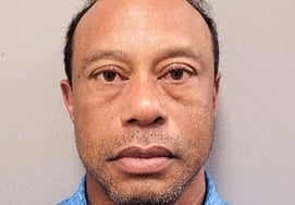 "Обвинение в вождении наркотиков" Тайгер Вудс опубликовал шокирующий снимок кружки "Странный цвет глаз""... "Спорная активность" до отказа от теста на мочу