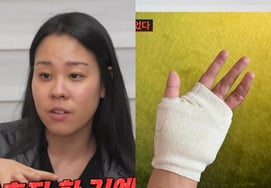 《仁顺伊的女儿》朴世仁，《斯坦福→MS公司》的精英..."因车祸失去手指，接受7次手术" [朝鲜爱情达人星TV]