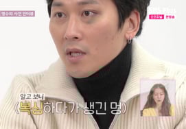 31st Young-soo appears for the first time with a bruised face, "Boxing match before the interview.."From Hongdae" [I'm solo]