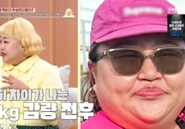 Hong Yun-hwa Releases Pictures Before and After Losing 40kg "Maximum Weight After Surgery for Cross Ligament" [equal rice]