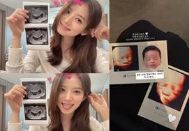 'Империя' Ким Джи Ён раскрыла стереоскопическое ультразвуковое изображение "Без моего лица ♥ Юн Су Ён Пан Бак"