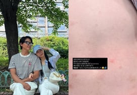 'Lee Ji-hoon ♥' Ayane, SOS During Second Pregnancy: "Hives + Severe Itching Every Night"