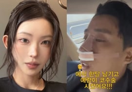 Chuyên gia phẫu thuật thẩm mỹ Choi Joon Hee cũng phẫu thuật mũi rồi "Nếu yêu thì giống nhau" Kinh ngạc [Star Issue]