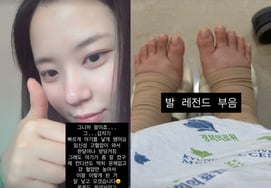 Choi Yeon Soo xác nhận tham gia bệnh viện huyết áp cao mang thai"Sinh sớm hơn một tháng"" [Star Issue]