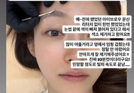 'Им Чан Чжон ♥' Сео белый, удаление пигментации татуировки бровей из-за коронарности "Флаг...Слушай сразу".
