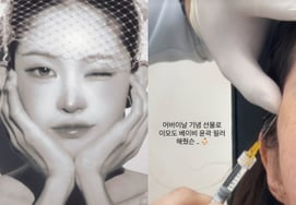 Cùng với dì.Món quà "Kỷ niệm Ngày Cha Mẹ" của Choi Joon Hee là phẫu thuật thổi sáo. [Star Issue]