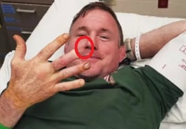 Shocking 'mysterious finger amputation': UFC champion says, "Still have nine left," with a chilling smile... Traffic accident → Coma for 19 days → Another 'bad omen'