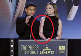 "Love traded for 30% body burns": 19-year-old soccer player who rushed into a burning building revealed his "glorious scars" at an awards ceremony