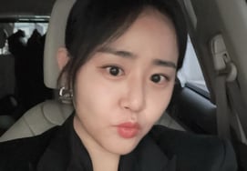 Moon Geun-young, un mes después de 'You Quiz on the Block', recupera la mitad de su rostro... pronto no será de 40 años, sino que encontrará la "edad de 20 años".