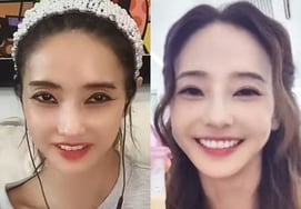 Han Chae-young, "Eyes Unfurrowed, No Longer Scary" vs. "Vibrant" — Latest Update Today (2nd) .. Health Concerns Dismissed [Star Issue]
