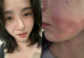 Kwon Min Ah bị tai nạn y tế tại Shrink → Thiệt hại nặng nề sau 4 thángBệnh viện đã nói là có tội đe dọa và đừng liên lạc với tôi". [Star Issue]