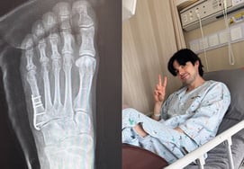 Robin shares sad news of a "metatarsal fracture"..."French hospitals are truly slower and less convenient than Korean ones"