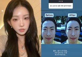 'Acknowledged as a 'Beauty Monster' Choi Jun-hee: "Too Much to Do" Considering Additional Plastic Surgery [Star Issue]