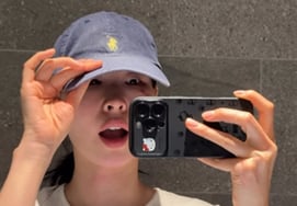 '乗り換え恋愛' チョン・ヘイム、結婚を控えて整形手術..あざのある顔を公開「目の後ろ・下切開」