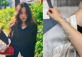 'Fighting cancer' Lee Sol-i says "Chemotherapy melted blood vessels"... Scars from injections remain on arm [Star Issue]