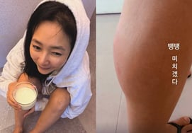 ジン・ジェヨン、ムカデに噛まれた事故で足が腫れる..「生きていると、いろいろなことが起きる」