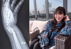 'Oh-hyeongje-mom' Jung Ju-ri, shocked by her 9-year-old second son's wrist fracture... "Dowon-ah?"