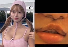 Sau khi phẫu thuật thẩm mỹ, Maeng Seung Ji khẳng định mình không thể giữ lời hứa vì bị sưng mặt [Star Issue]