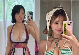 Lee Se-young and Maeng Seung-ji: Plastic surgery and exposure overshadow their main profession [Star Issue]