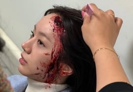 "什么事?"..惠利,满脸血迹地脸庞公开