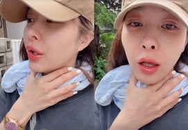 玉珠铉、金浩英狙击事件之后……健康提醒“警惕扁桃体炎和喉炎”[Star Issue]