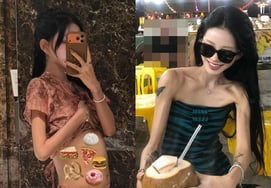 Choi Jun-hee, "Thought my emaciated arms were like Groot trees... 'Underweight is more livable'"