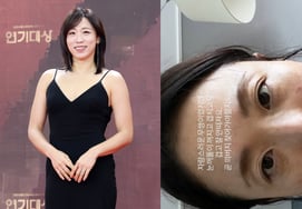 Lee Mi-do, Honest About Appearance Concerns: "Eyelids Drooping... Might Need to See a Doctor"